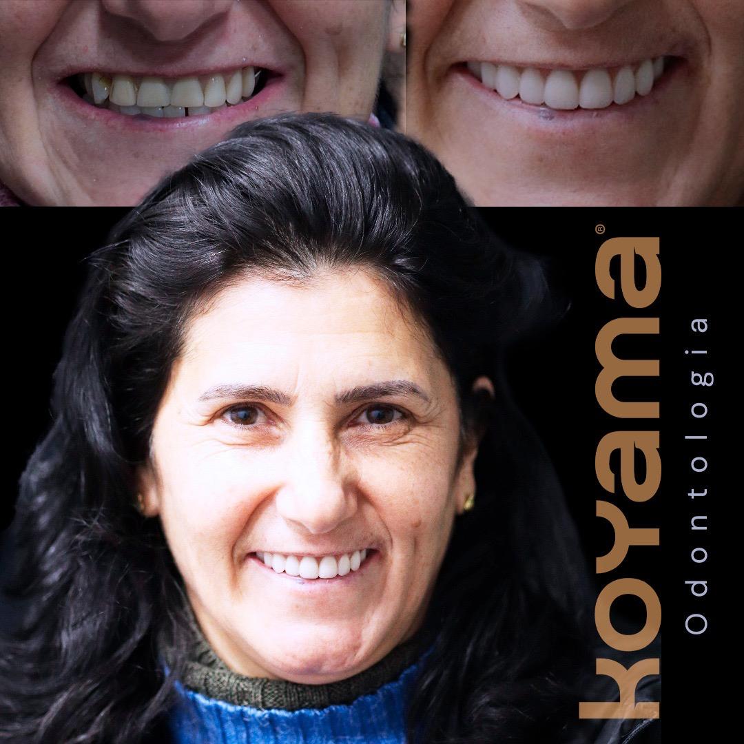 Antes e depois - transformação completa com logo Koyama